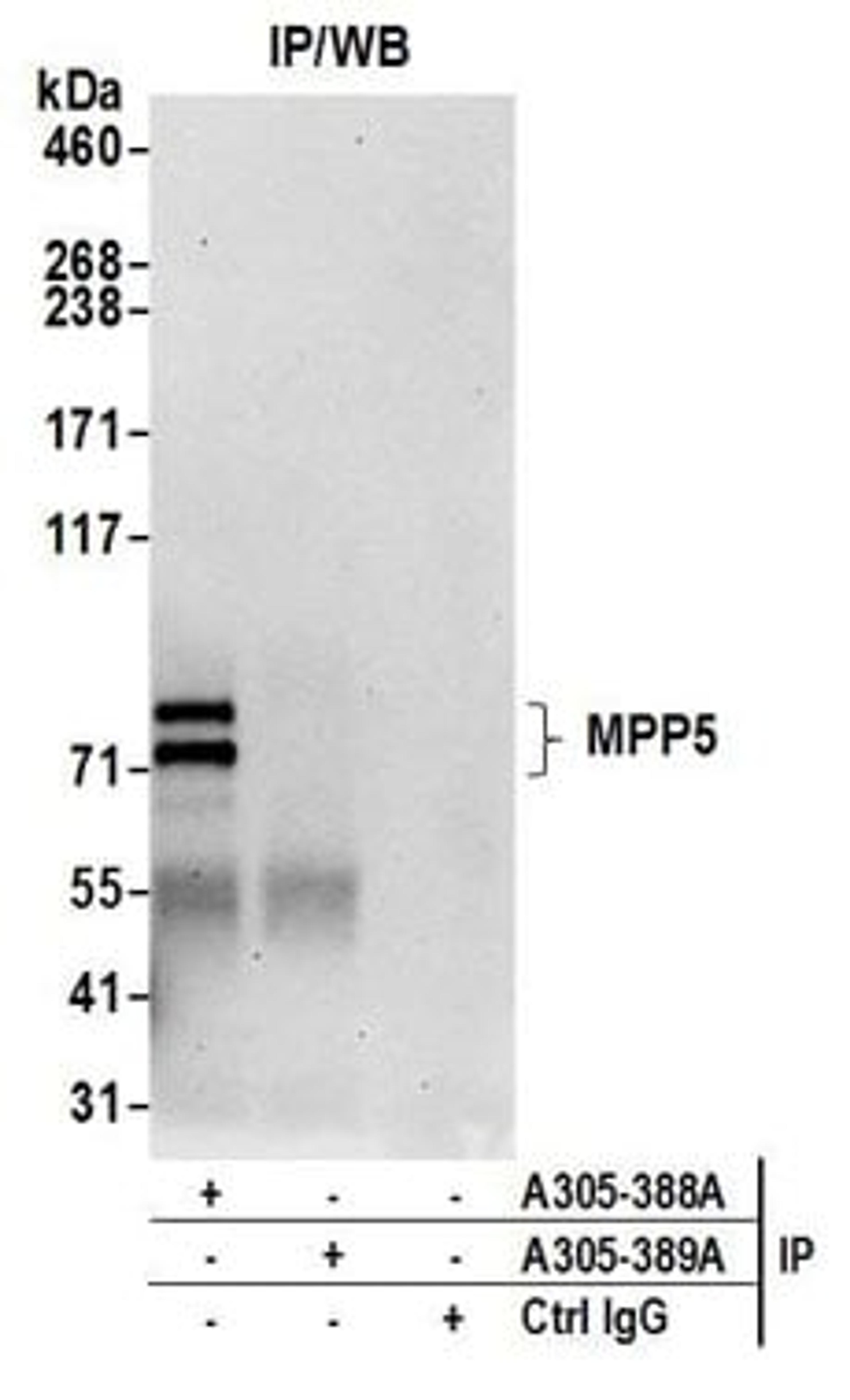 Detection of human MPP5 by western blot of immunoprecipitates.