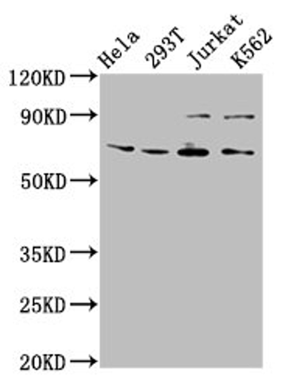 Western Blot. Positive WB detected in: Hela whole cell lysate, 293T whole cell lysate, Jurkat whole cell lysate, K562 whole cell lysate. All lanes: ALG9 antibody at 6.3µg/ml. Secondary. Goat polyclonal to rabbit IgG at 1/50000 dilution. Predicted band size: 70, 51, 71, 52 kDa. Observed band size: 70 kDa