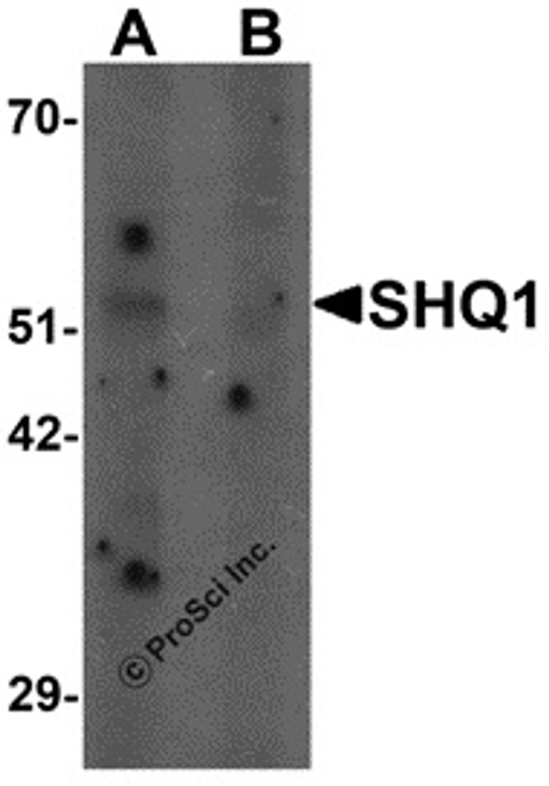 Western blot analysis of SHQ1 in human heart tissue lysate with SHQ1 antibody at 1 μg/mL in (A) the absence and (B) the presence of blocking peptide.