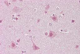 Antibody used in IHC.