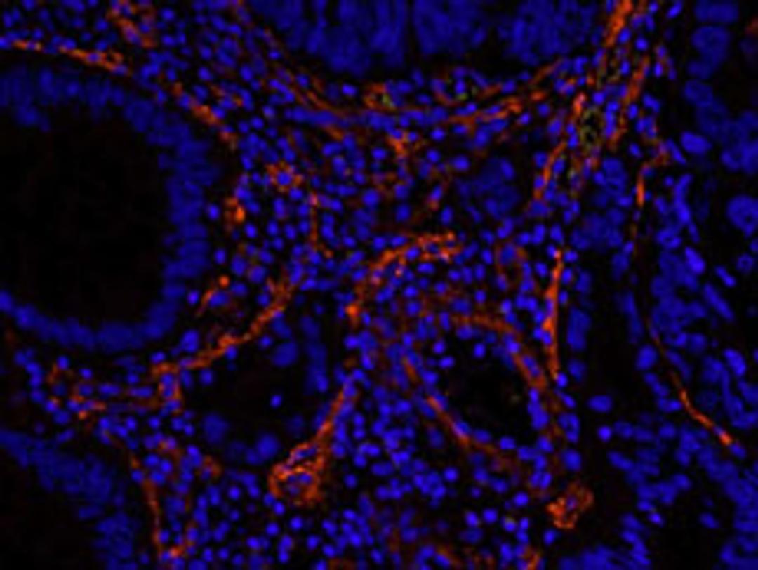 Detection of human Filamin by immunohistochemistry.