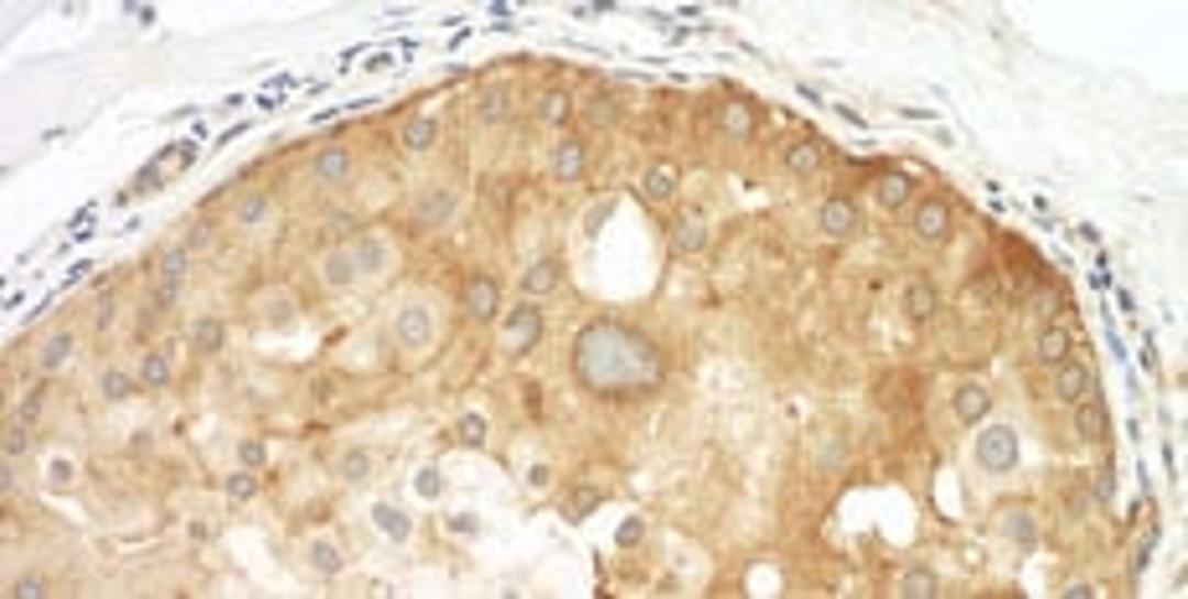 Detection of human Septin 9 by immunohistochemistry.