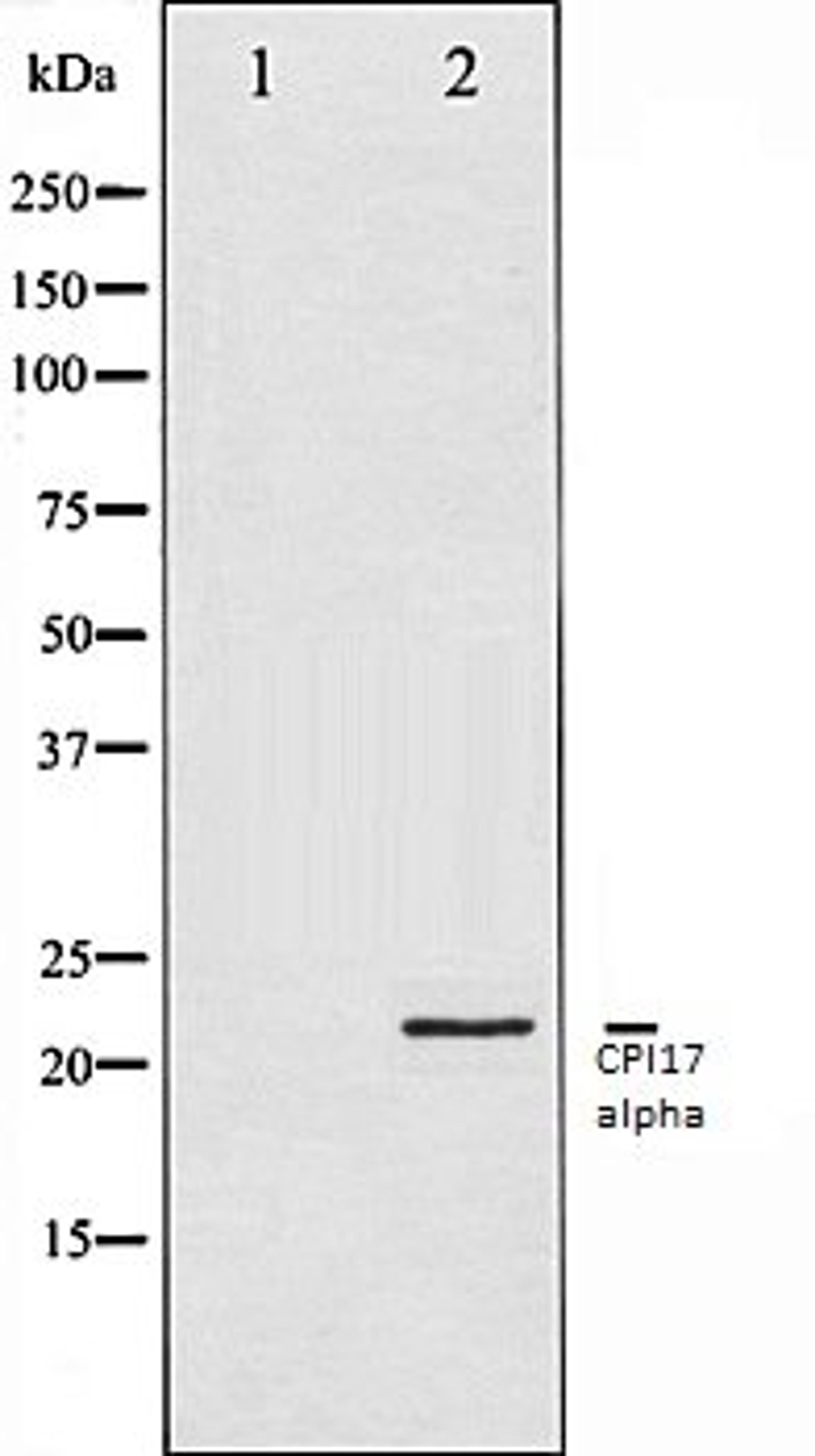 Western blot analysis of HT29 whole cell lysates using CPI17alpha antibody, The lane on the left is treated with the antigen-specific peptide.