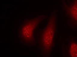 Immunocytochemistry/Immunofluorescence: RSK1 [p Thr348] Antibody [NB100-82125] - Staining of methanol-fixed Hela cells using p90RSK(Phospho-Thr348) antibody