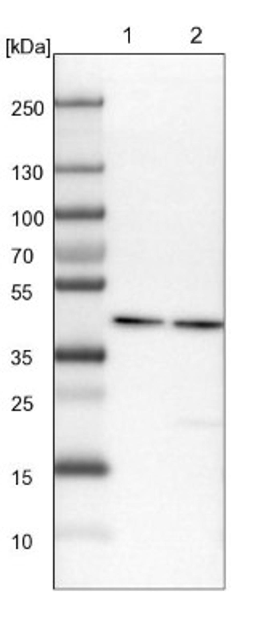 Western Blot: HPD Antibody [NBP1-89366] - Lane 1: Mouse liver tissue lysate<br/>Lane 2: Rat liver tissue lysate