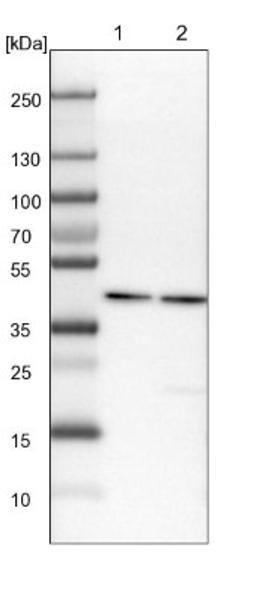 Western Blot: HPD Antibody [NBP1-89366] - Lane 1: Mouse liver tissue lysate<br/>Lane 2: Rat liver tissue lysate