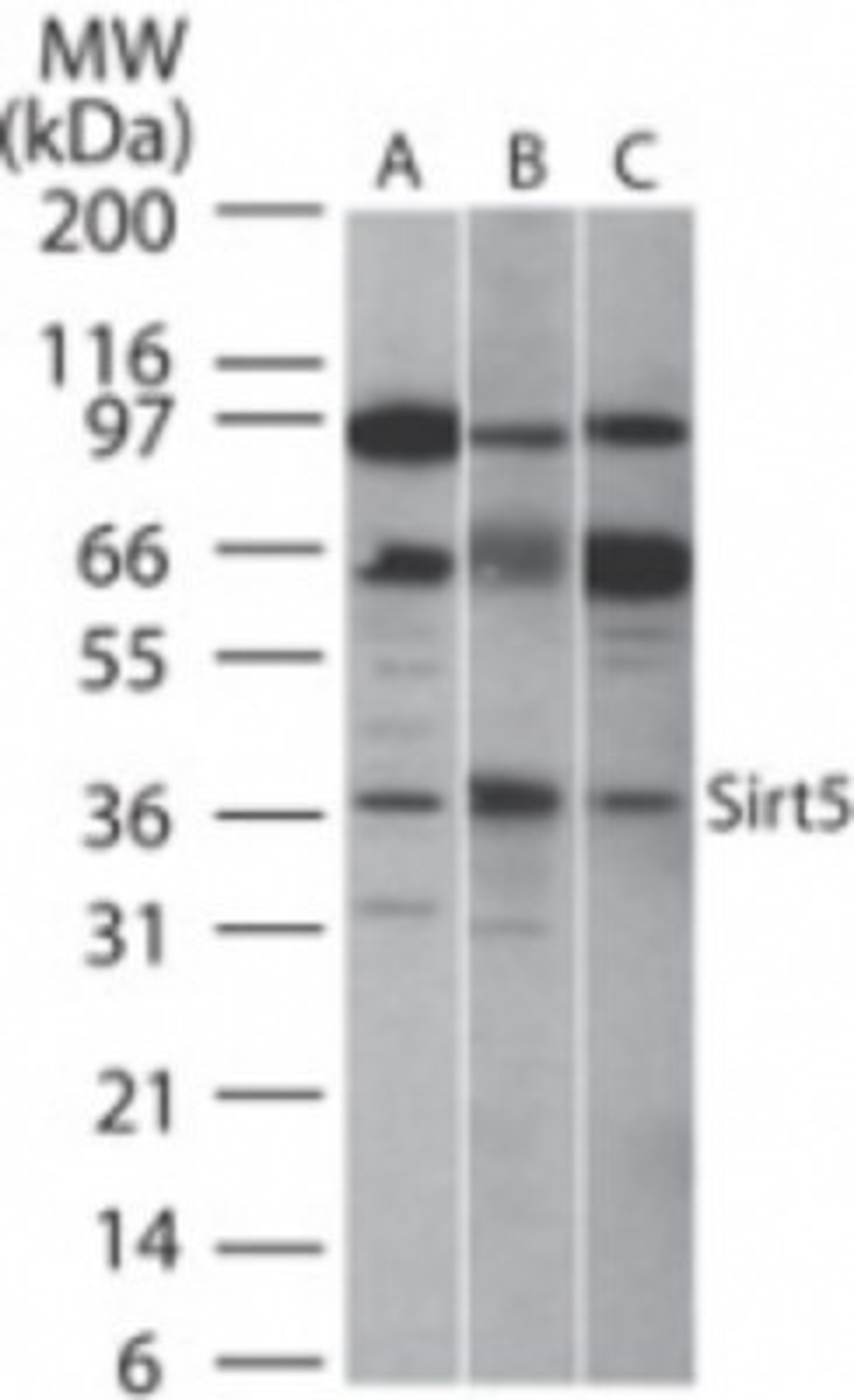 Western Blot: SIRT5 Antibody [NB100-56372] - Analysis of SIRT5 in A) human, B) mouse and C) rat intestine cell lysate using this antibody at 2 ug/ml.