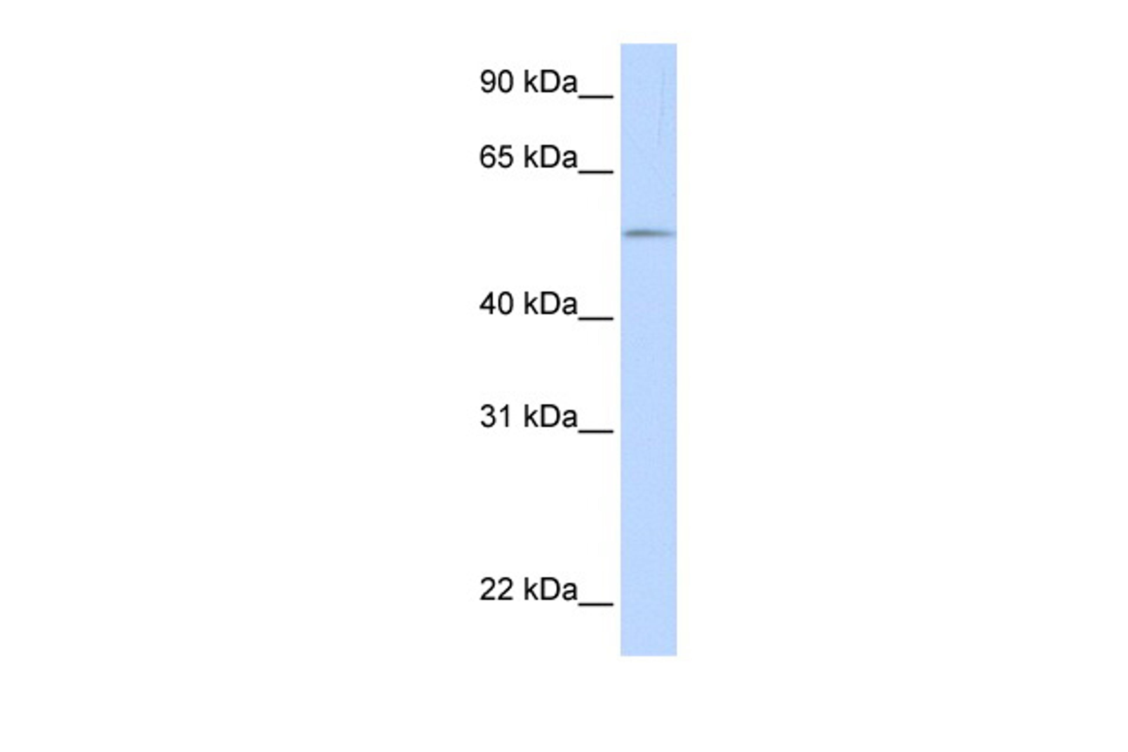 Antibody used in WB on Human Muscle at 0.2-1 ug/ml.