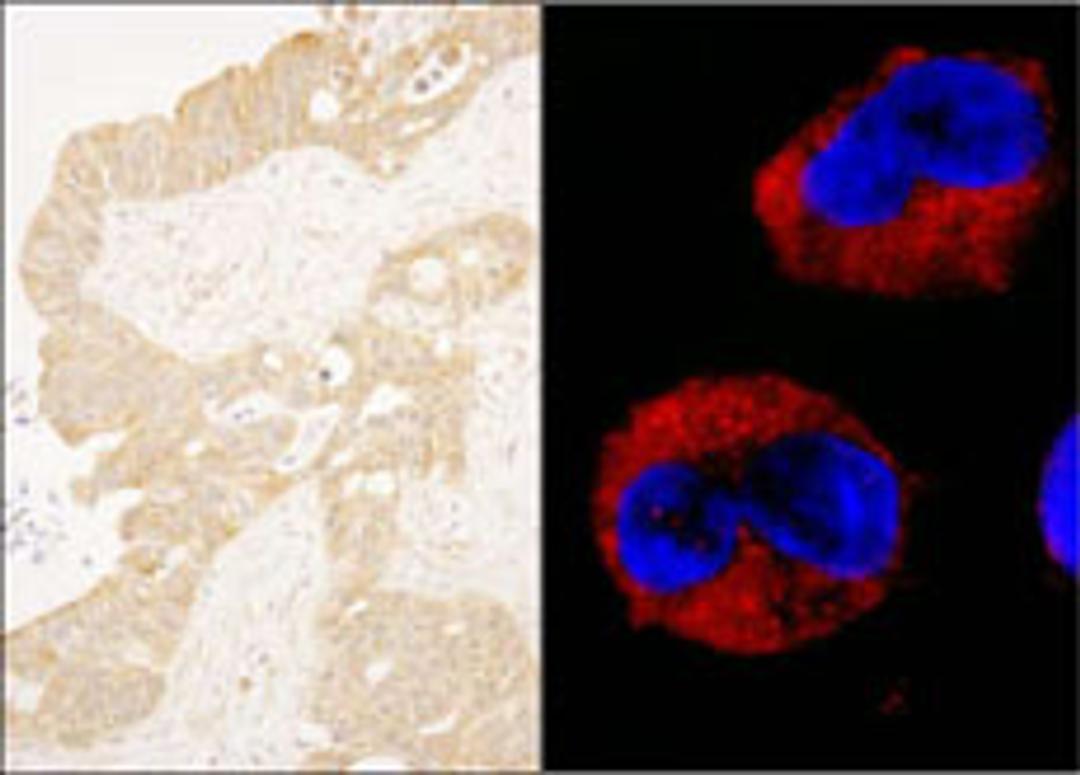 Detection of human cAbl by immunohistochemistry and immunocytochemistry.