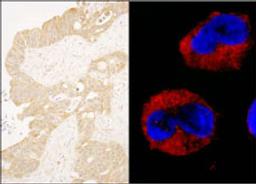 Detection of human cAbl by immunohistochemistry and immunocytochemistry.