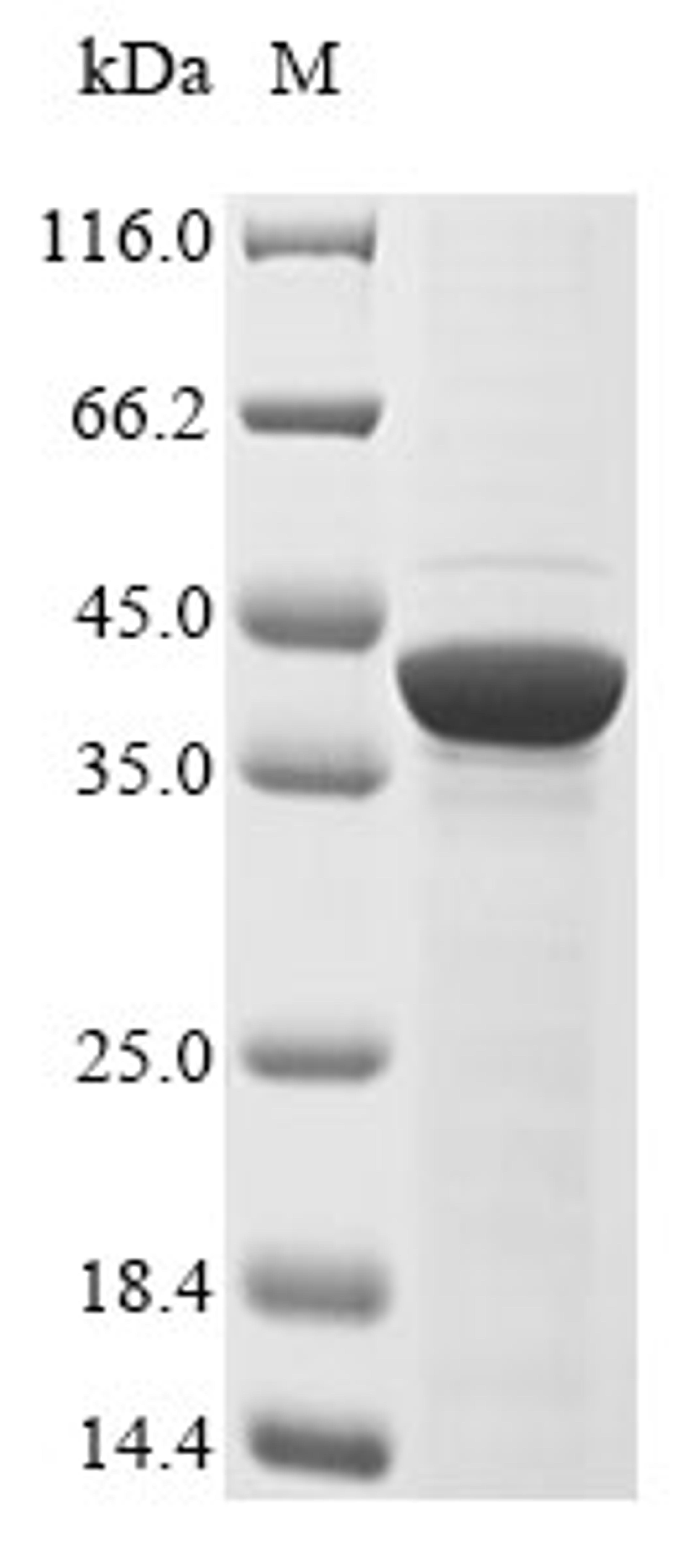 (Tris-Glycine gel) Discontinuous SDS-PAGE (reduced) with 5% enrichment gel and 15% separation gel.