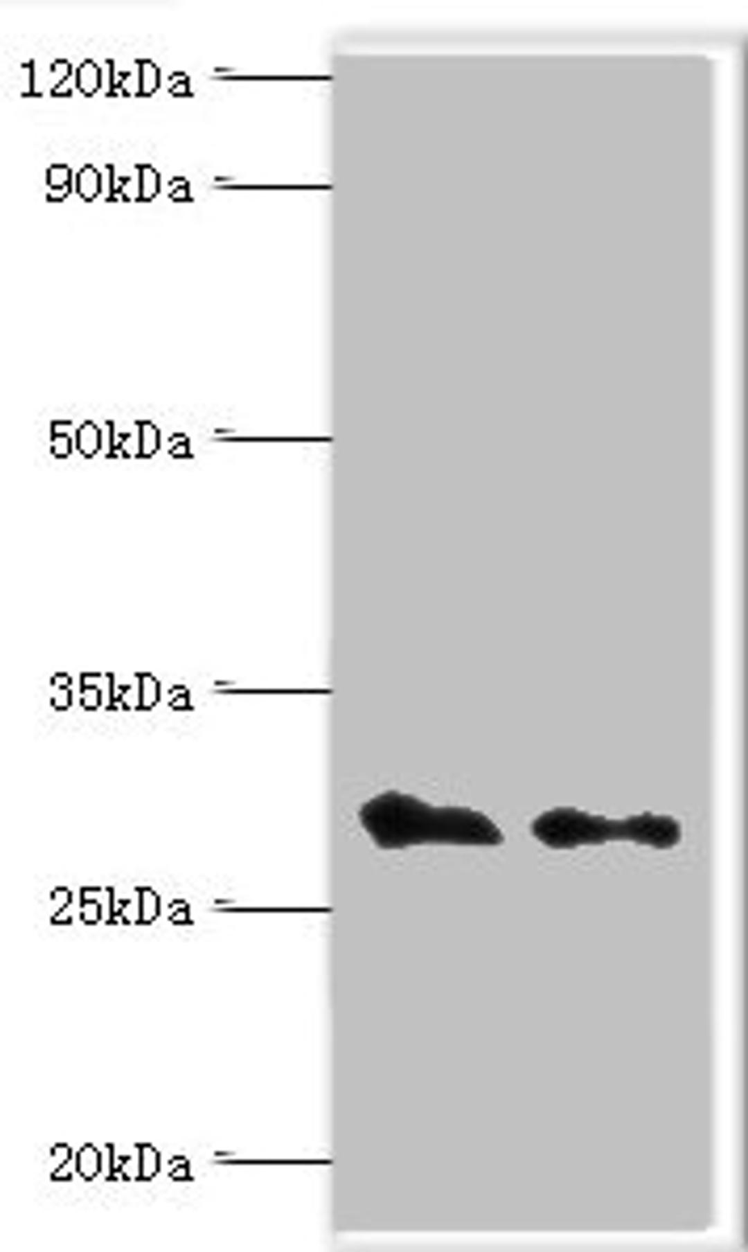 Western blot. All lanes: COP9 signalosome complex subunit 7a antibody at 4ug/ml. Lane 1: Rat heart tissue. Lane 2: Rat brain tissue. Secondary. Goat polyclonal to rabbit IgG at 1/10000 dilution. Predicted band size: 30 kDa. Observed band size: 30 kDa. 