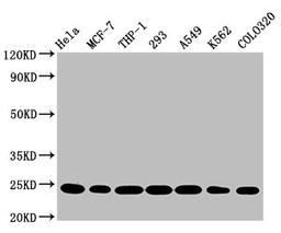 Western Blot. Positive WB detected in: Hela whole cell lysate, MCF-7 whole cell lysate, THP-1 whole cell lysate, 293 whole cell lysate, A549 whole cell lysate, K562 whole cell lysate, Colo320 whole cell lysate. All lanes: BAK1 antibody at 0.9μg/ml. Secondary. Goat polyclonal to rabbit IgG at 1/50000 dilution. Predicted band size: 24, 17 KDa. Observed band size: 24 KDa.
