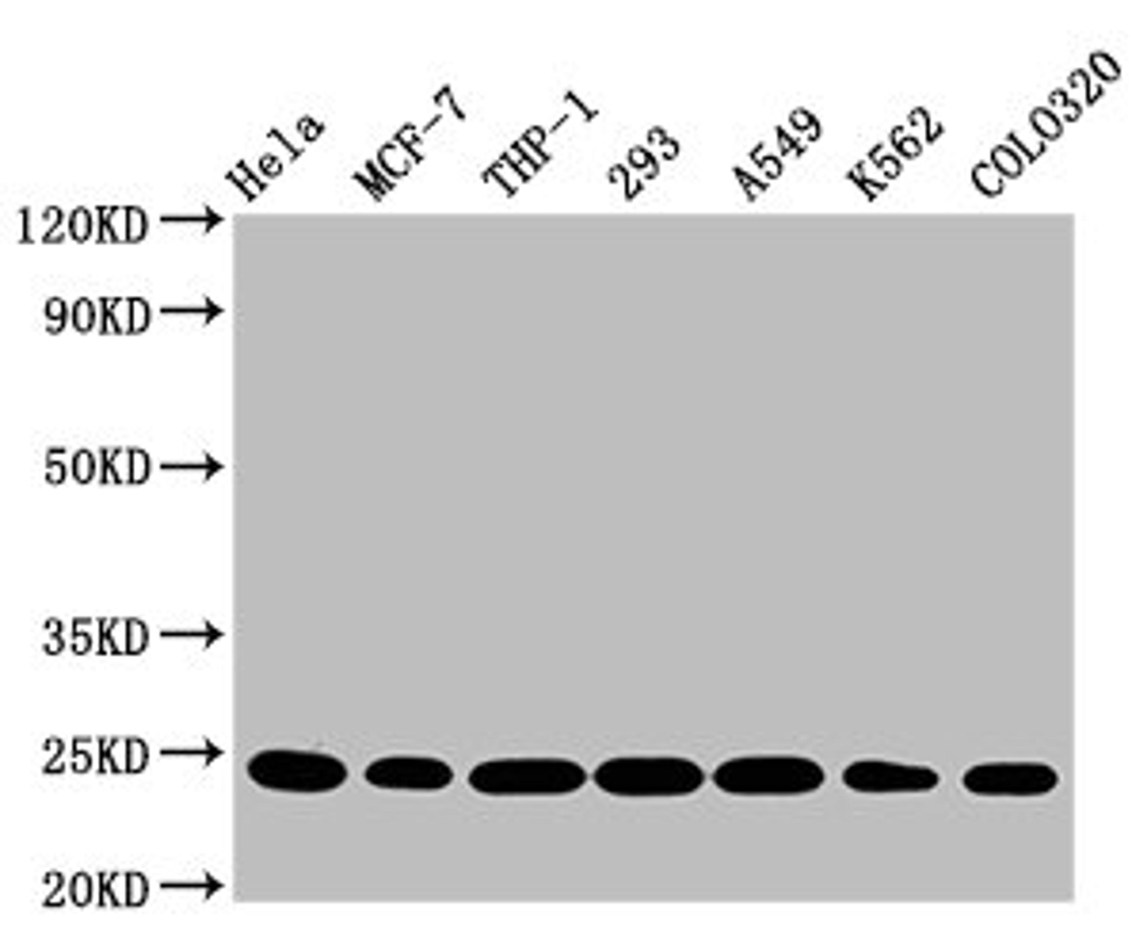 Western Blot. Positive WB detected in: Hela whole cell lysate, MCF-7 whole cell lysate, THP-1 whole cell lysate, 293 whole cell lysate, A549 whole cell lysate, K562 whole cell lysate, Colo320 whole cell lysate. All lanes: BAK1 antibody at 0.9μg/ml. Secondary. Goat polyclonal to rabbit IgG at 1/50000 dilution. Predicted band size: 24, 17 KDa. Observed band size: 24 KDa.