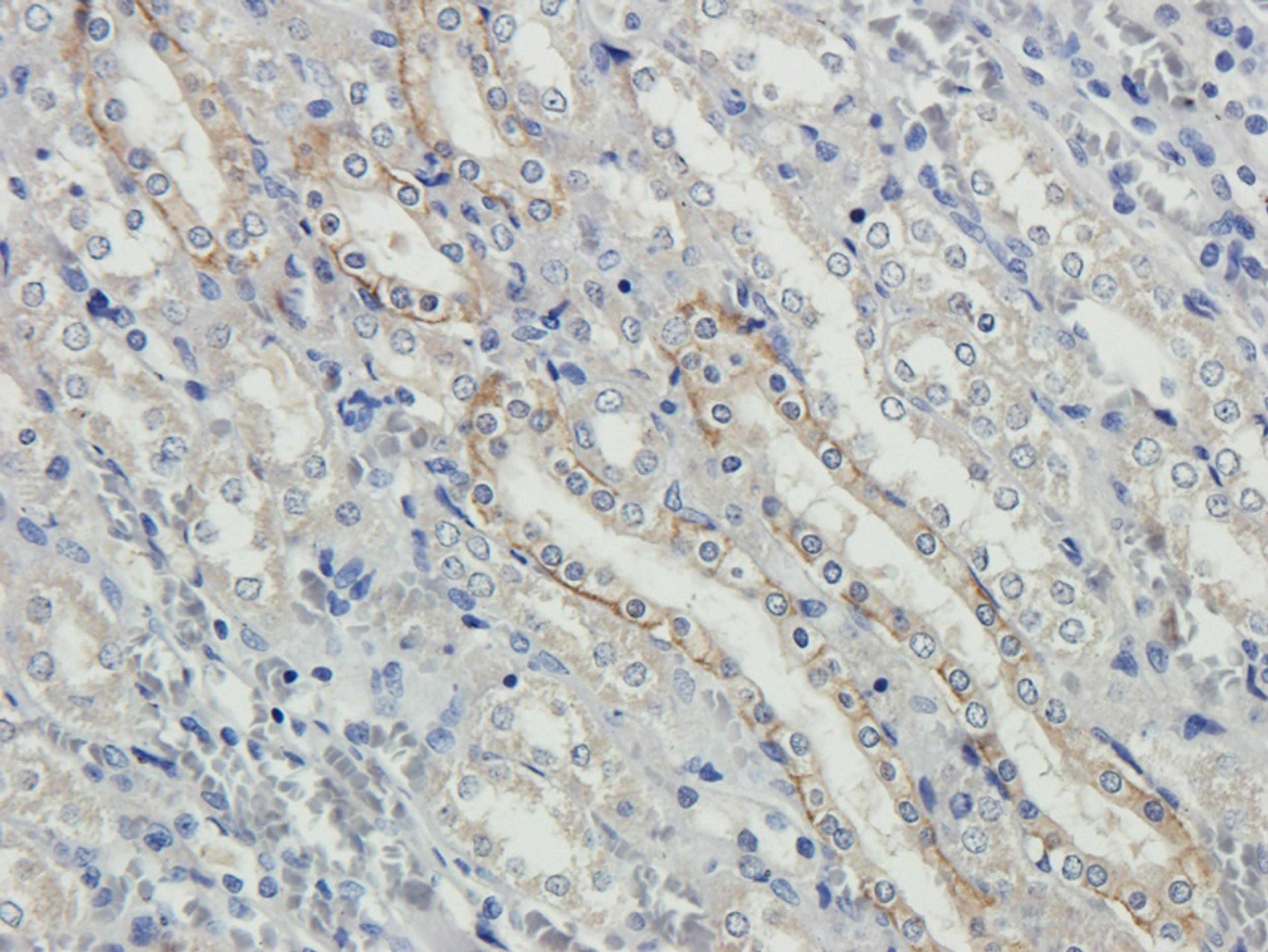 Immunohistochemical staining of paraffin embedded rat kidney tissue using NKp46 antibody (2.5 ug/ml)