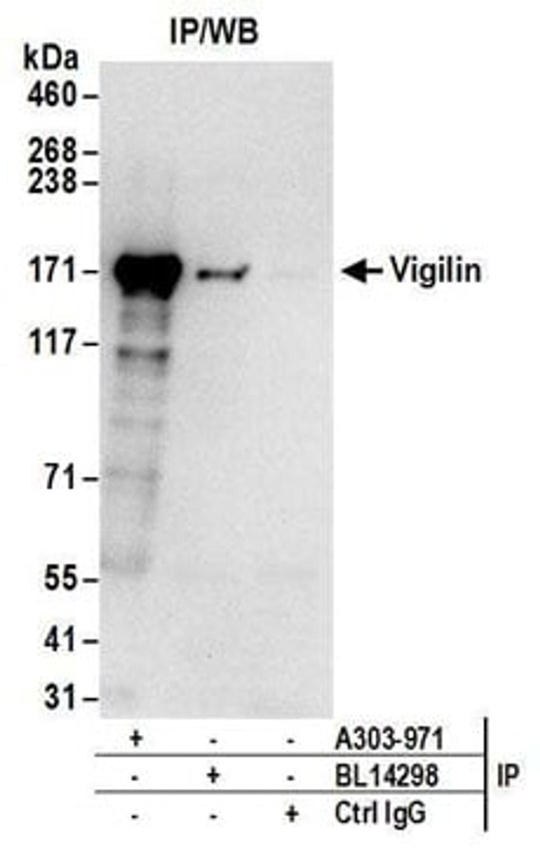 Detection of human Vigilin by western blot of immunoprecipitates.