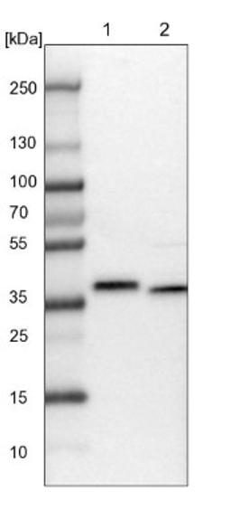 Western Blot: CCDC75 Antibody [NBP1-93801] - Lane 1: NIH-3T3 cell lysate (Mouse embryonic fibroblast cells)<br/>Lane 2: NBT-II cell lysate (Rat Wistar bladder tumour cells)