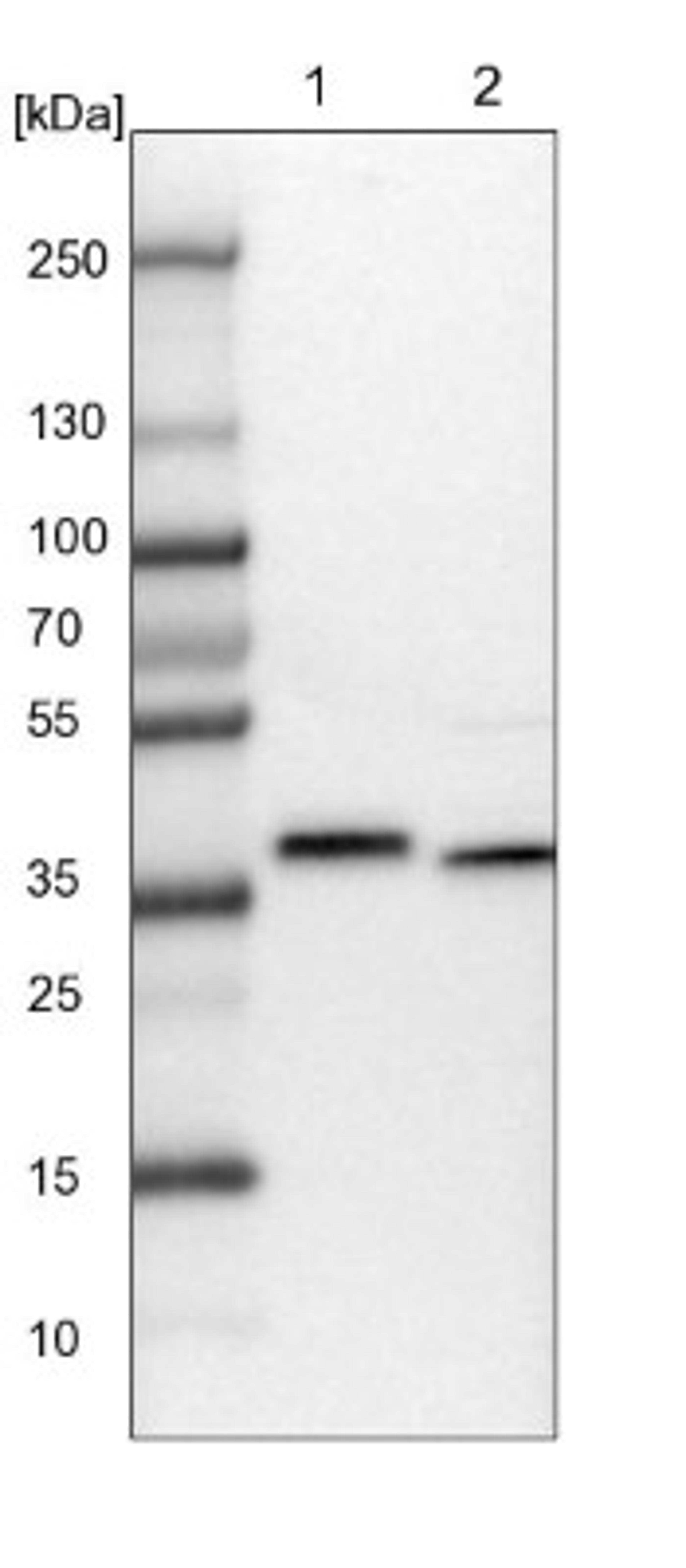 Western Blot: CCDC75 Antibody [NBP1-93801] - Lane 1: NIH-3T3 cell lysate (Mouse embryonic fibroblast cells)<br/>Lane 2: NBT-II cell lysate (Rat Wistar bladder tumour cells)