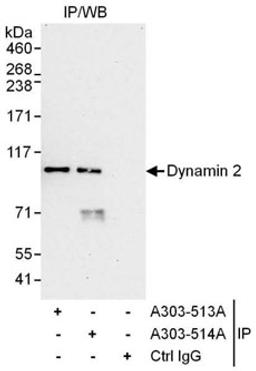 Detection of human Dynamin 2 by western blot of immunoprecipitates.