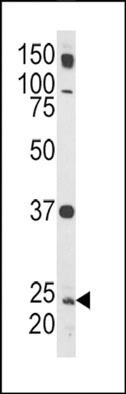 Western blot analysis of Rab5 Antibody in HL-60 cell line lysates (35ug/lane)