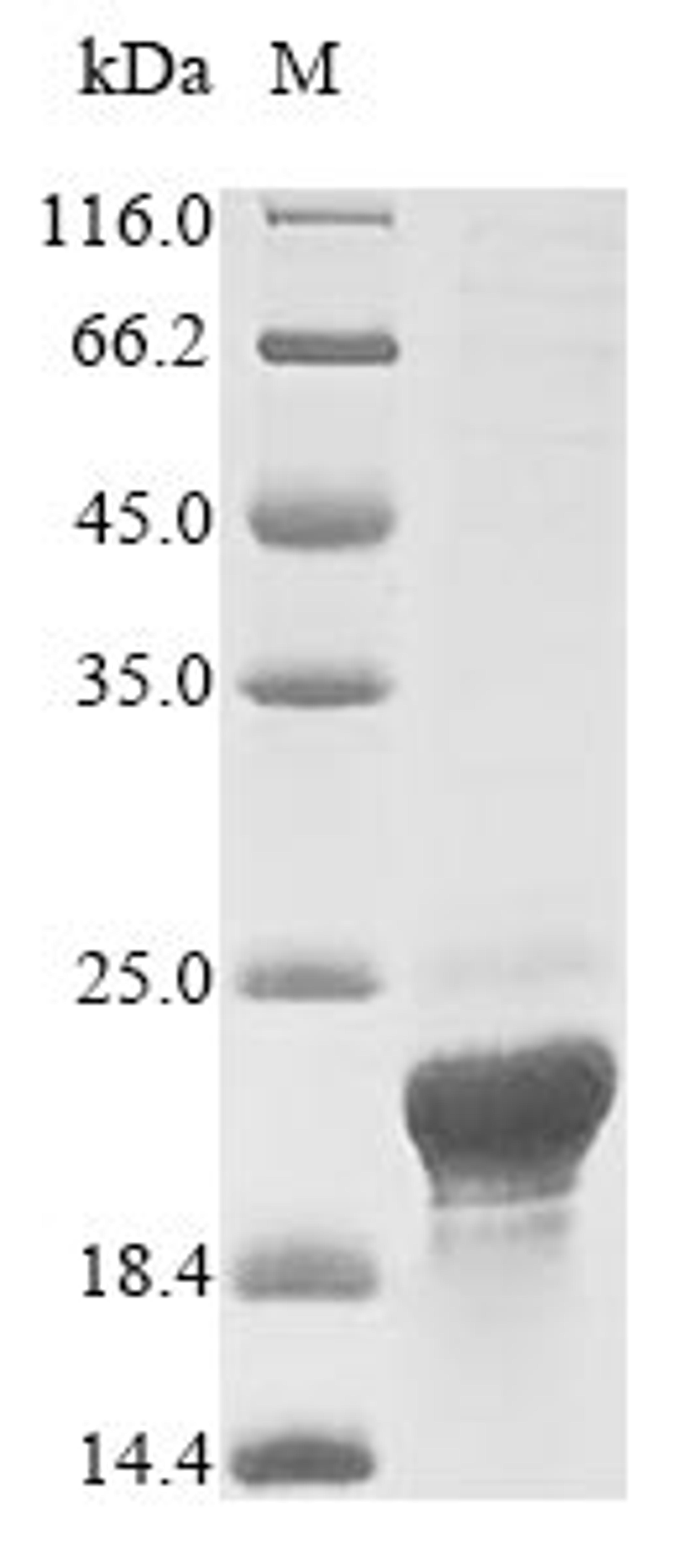 (Tris-Glycine gel) Discontinuous SDS-PAGE (reduced) with 5% enrichment gel and 15% separation gel.