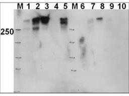 Western blot analysis of Fus1 untreated, Fus1 IR (20Gy, 4h), Fus1 DNAPK inhibitor + IR, MO59J (DNAPK-) untreated, MO59J IR, Fus1 untreated, Fus1 IR (20Gy, 4h), Fus1 DNAPK inhibitor + IR, MO59J untreated, MO59J IR using DNA PKcs pT 2609 antibody