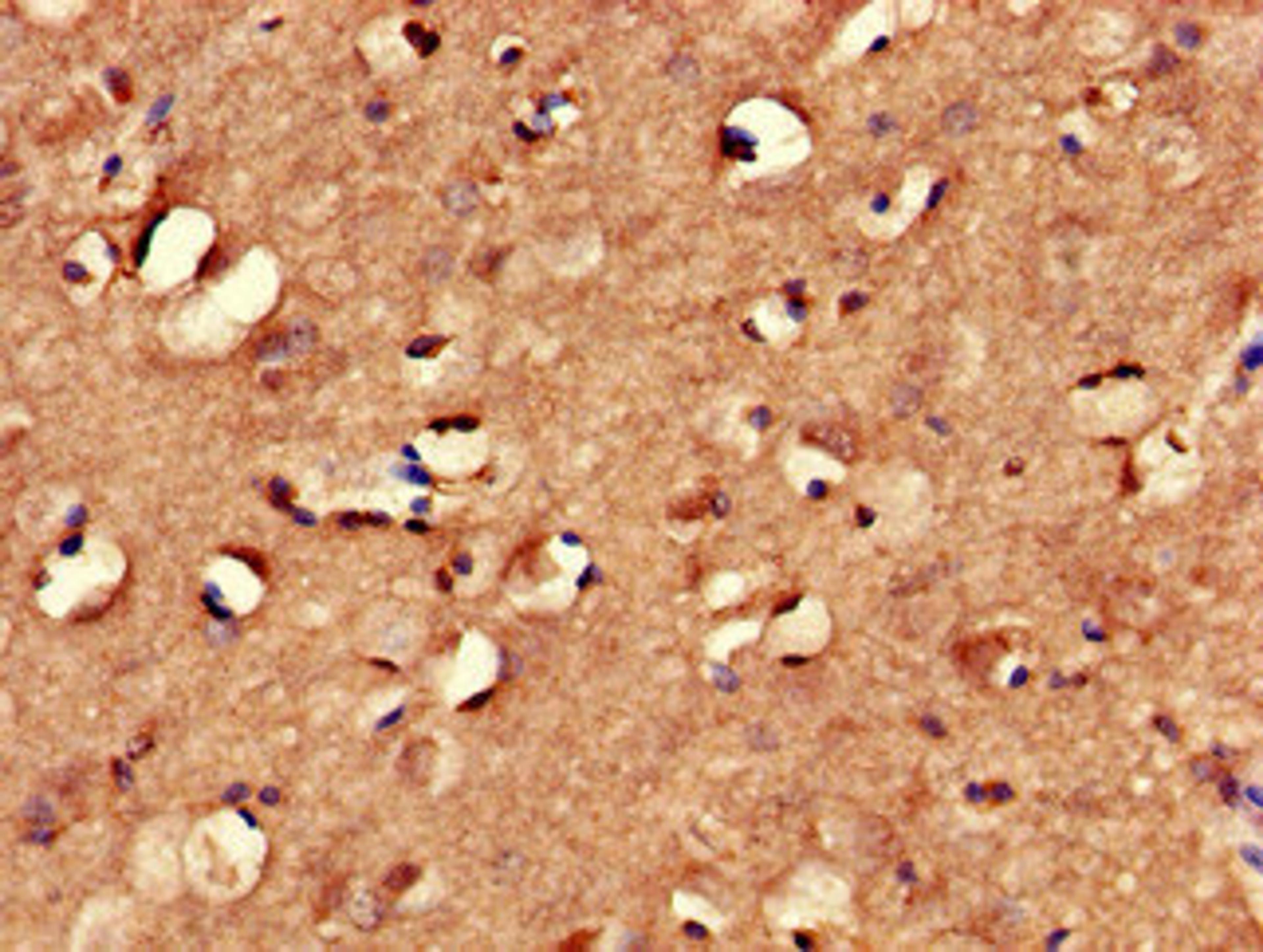 Immunohistochemistry of paraffin-embedded human brain tissue using CSB-PA839876LA01HU at dilution of 1:100