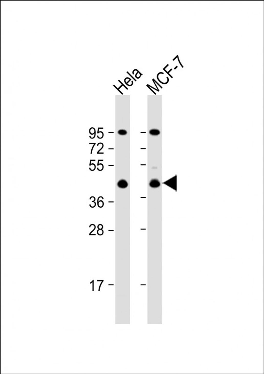 Western Blot at 1:1000 dilution Lane 1: Hela whole cell lysate Lane 2: MCF-7 whole cell lysate Lysates/proteins at 20 ug per lane.