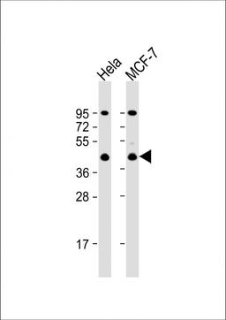 Western Blot at 1:1000 dilution Lane 1: Hela whole cell lysate Lane 2: MCF-7 whole cell lysate Lysates/proteins at 20 ug per lane.