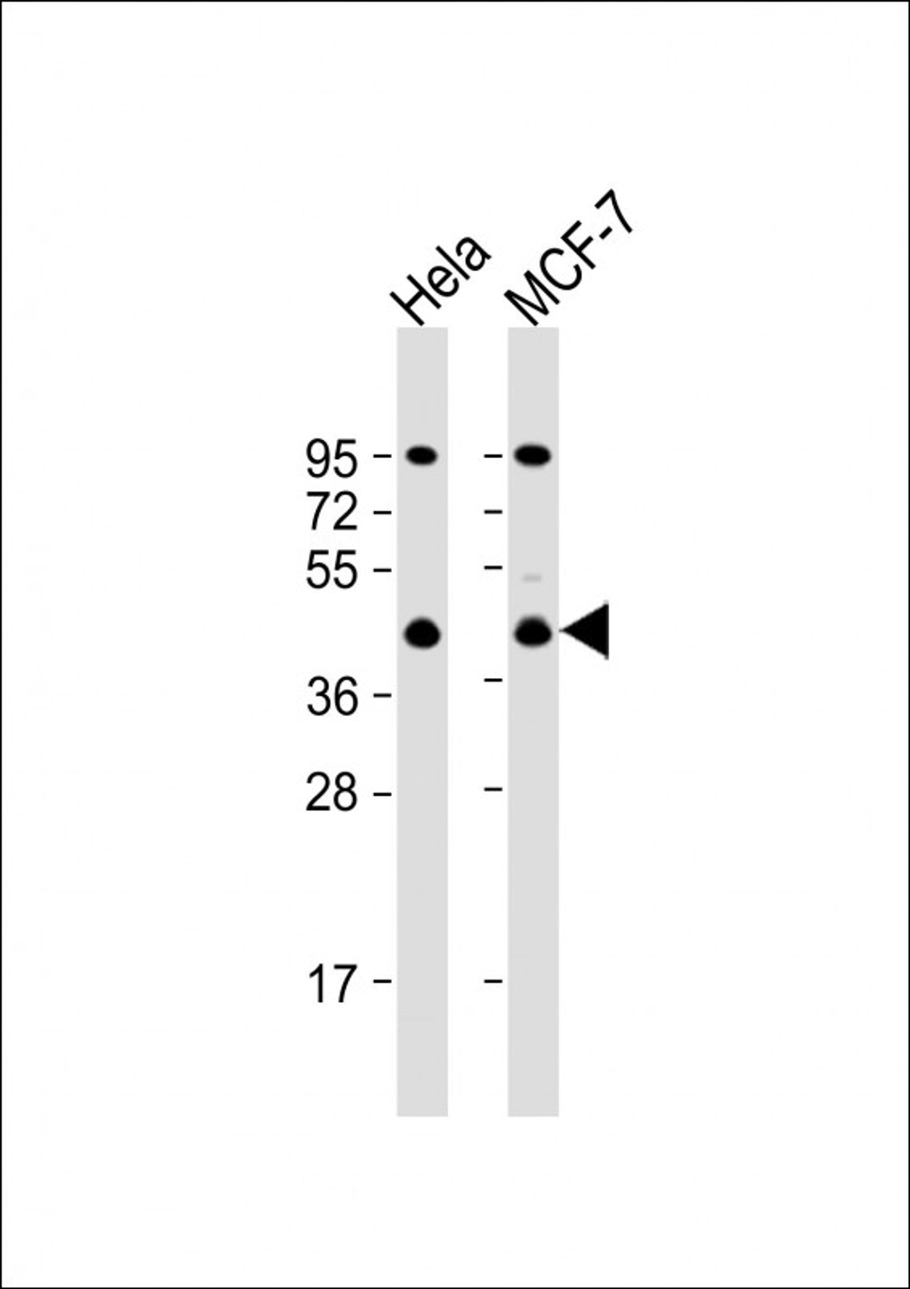 Western Blot at 1:1000 dilution Lane 1: Hela whole cell lysate Lane 2: MCF-7 whole cell lysate Lysates/proteins at 20 ug per lane.