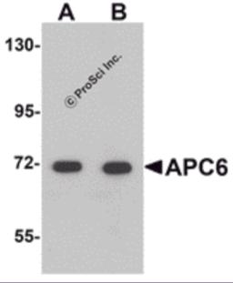 Western blot analysis of APC6 in human liver tissue lysate with APC6 antibody at (A) 1 and (B) 2 &#956;g/mL.