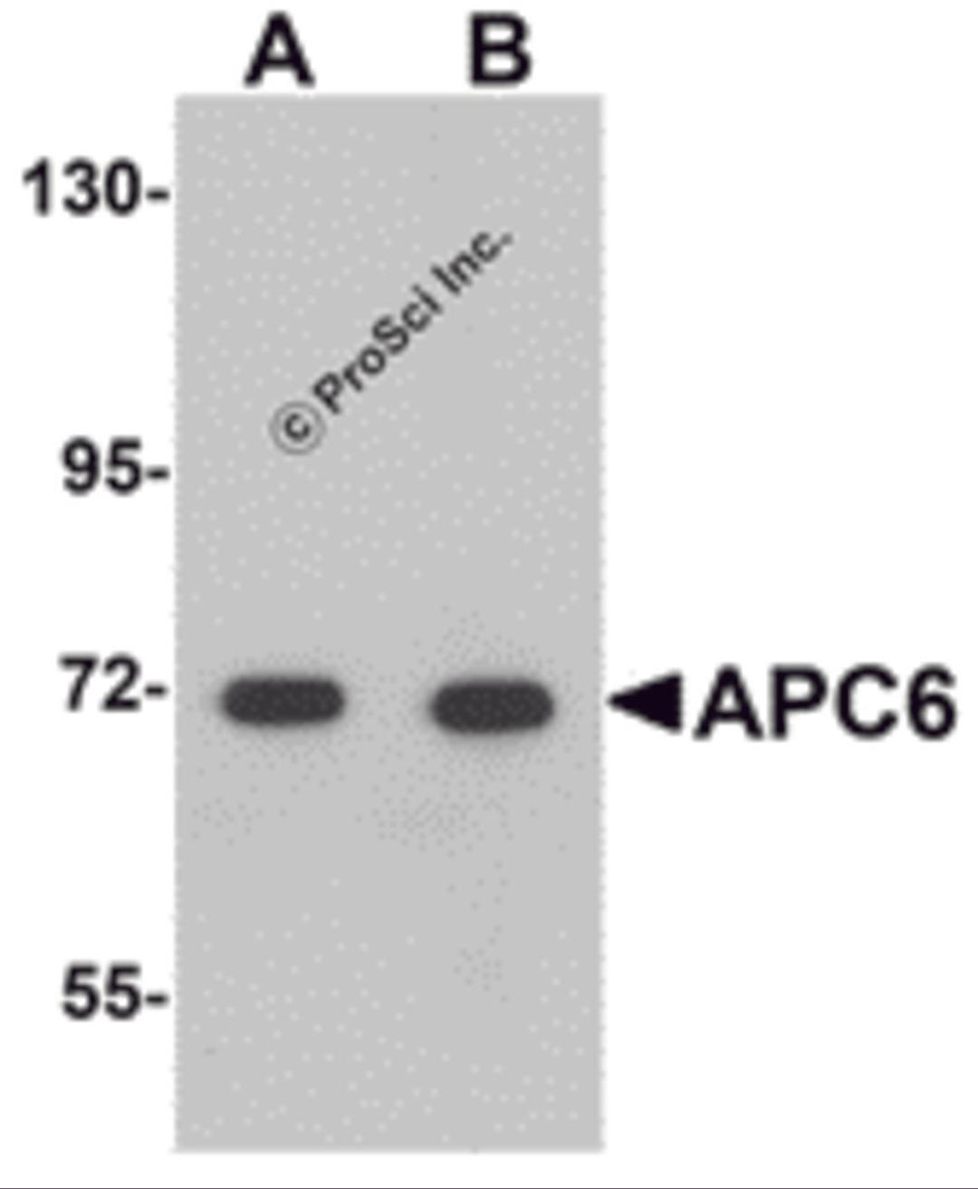 Western blot analysis of APC6 in human liver tissue lysate with APC6 antibody at (A) 1 and (B) 2 μg/mL.
