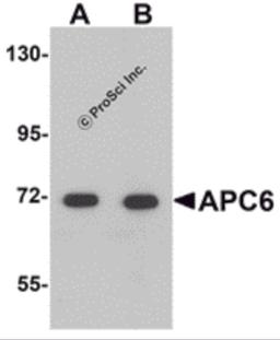 Western blot analysis of APC6 in human liver tissue lysate with APC6 antibody at (A) 1 and (B) 2 μg/mL.