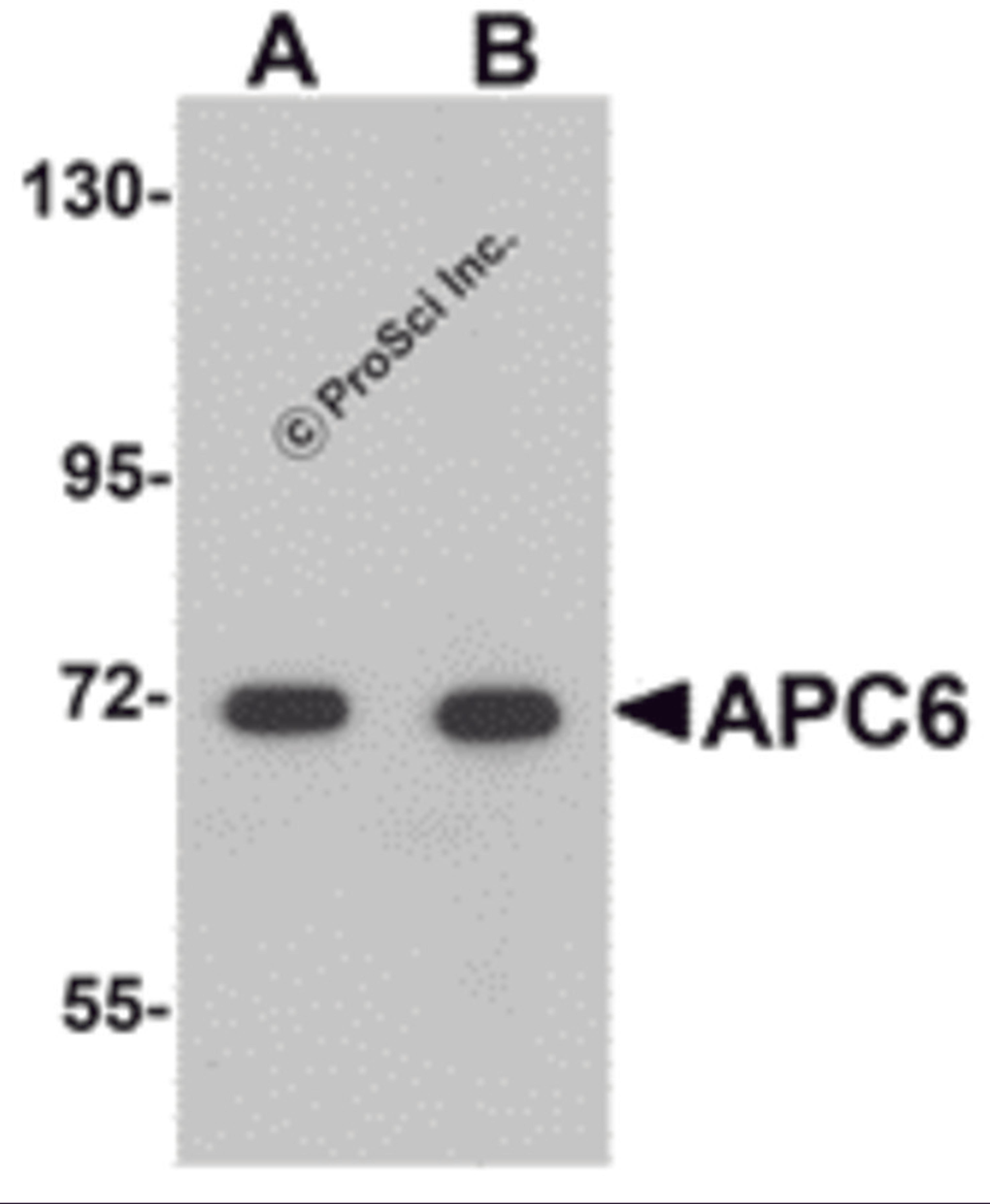 Western blot analysis of APC6 in human liver tissue lysate with APC6 antibody at (A) 1 and (B) 2 μg/mL.