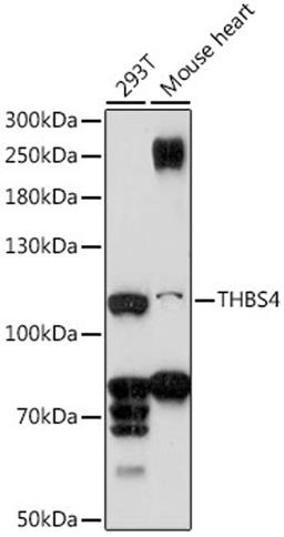 Western blot - THBS4 antibody (A16438)