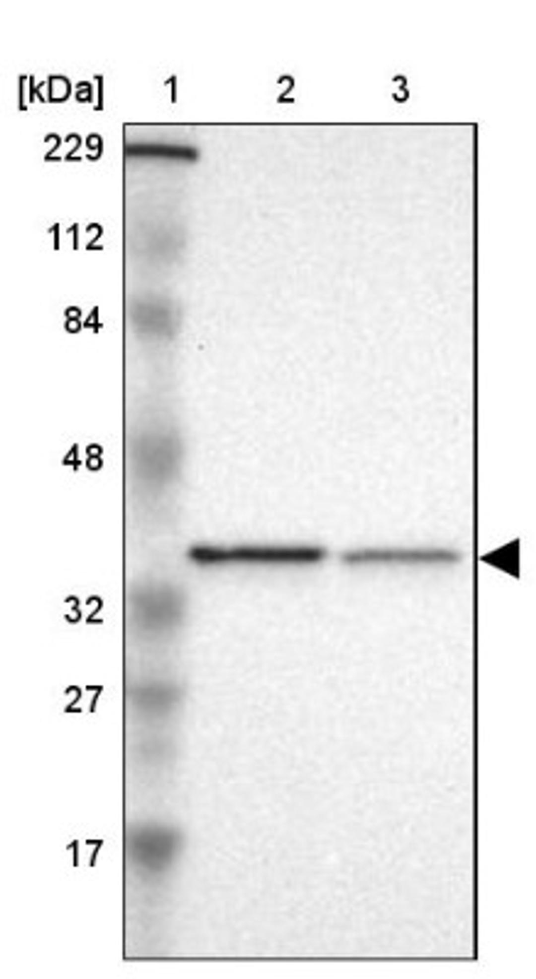 Western Blot: actin-related protein 2/3 complex subunit 1B Antibody [NBP1-90114] - Lane 1: Marker [kDa] 229, 112, 84, 48, 32, 27, 17<br/>Lane 2: Human cell line RT-4<br/>Lane 3: Human cell line U-251MG sp