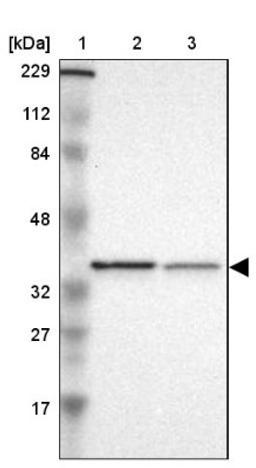 Western Blot: actin-related protein 2/3 complex subunit 1B Antibody [NBP1-90114] - Lane 1: Marker [kDa] 229, 112, 84, 48, 32, 27, 17<br/>Lane 2: Human cell line RT-4<br/>Lane 3: Human cell line U-251MG sp