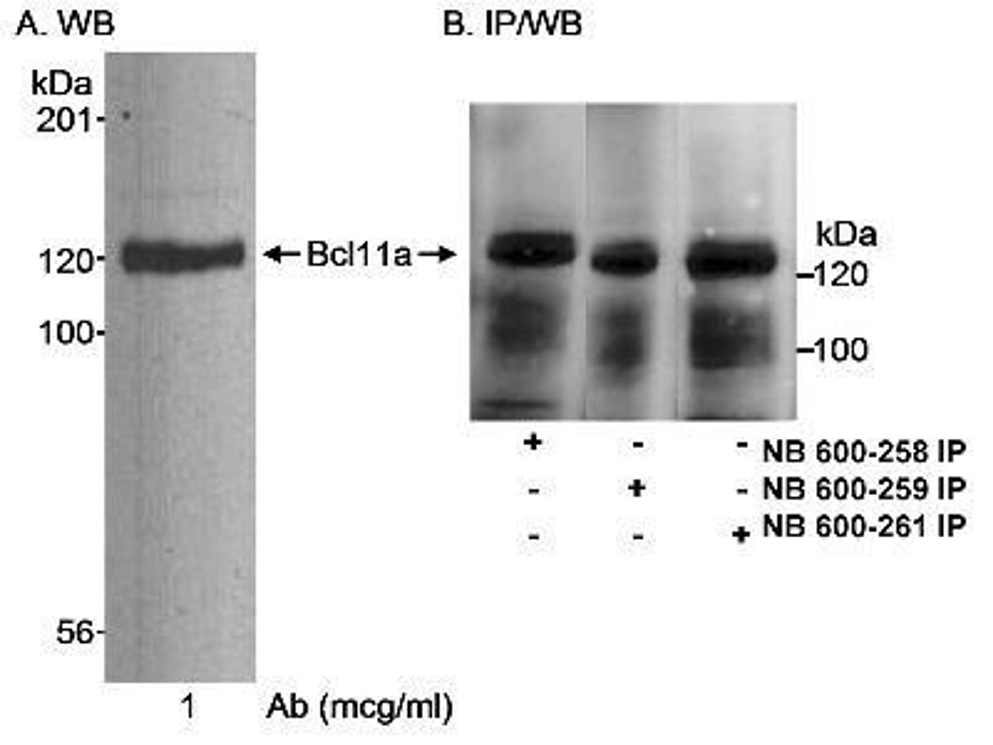 Immunoprecipitation: Ctip1 Antibody [NB600-261] - Detection of Human Bcl11a on HeLa whole cell lysate using NB600-261. Bcl11a was also immunoprecipitated using affinity purified rabbit anti-Bcl11a antibodies NB600-258 and NB600-259.