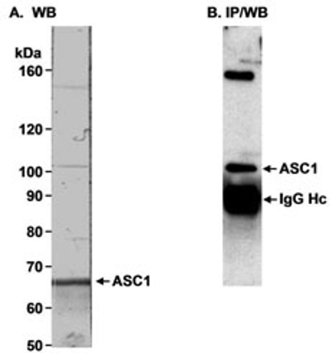 Detection of human TRIP4/ASC1 by western blot and immunoprecipitation.