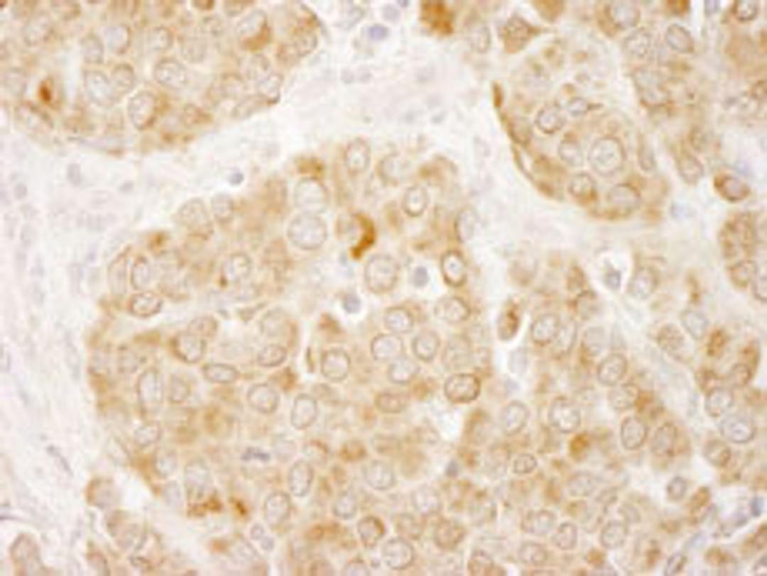 Detection of human IRS1 by immunohistochemistry.