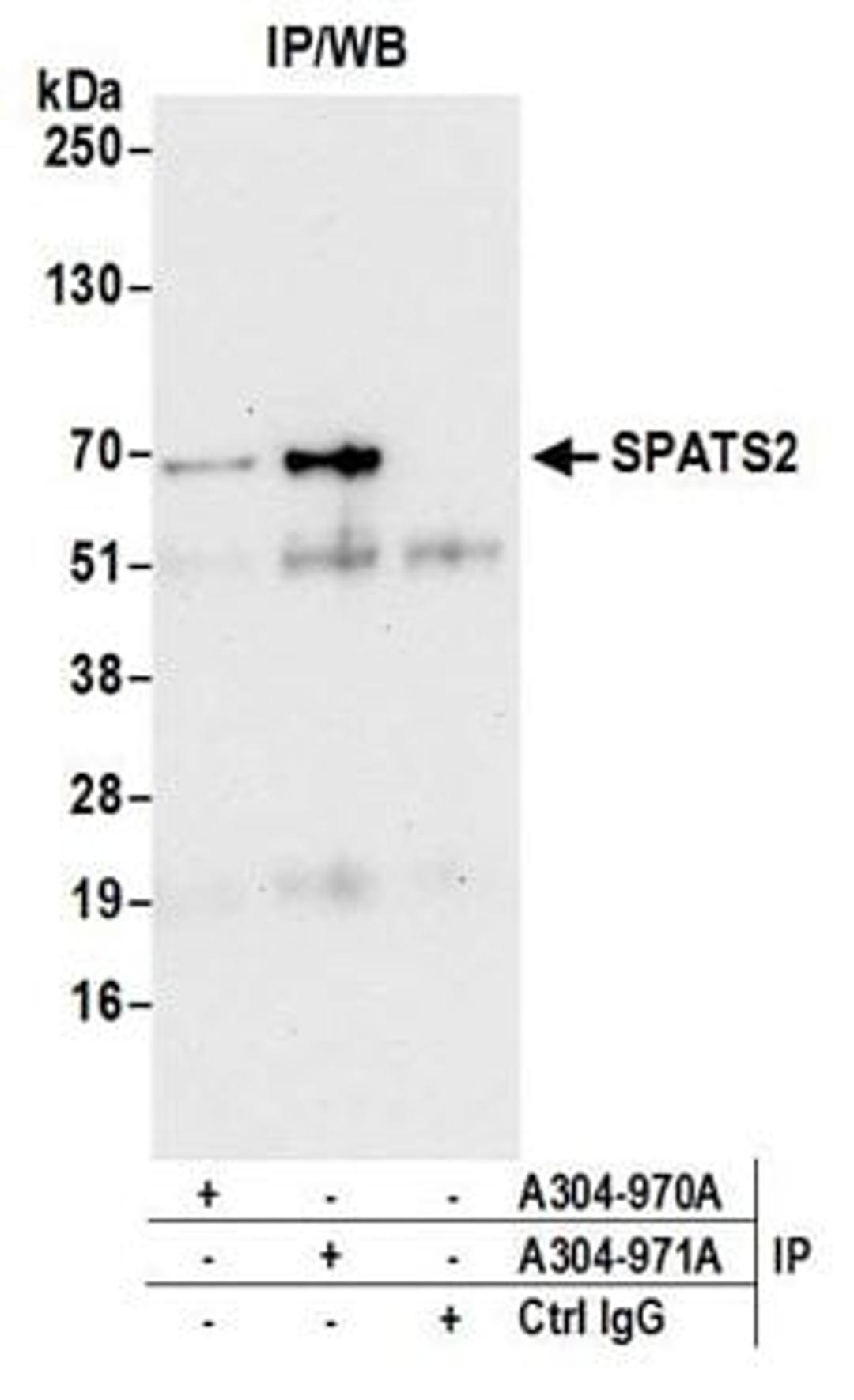 Detection of human SPATS2 by western blot of immunoprecipitates.