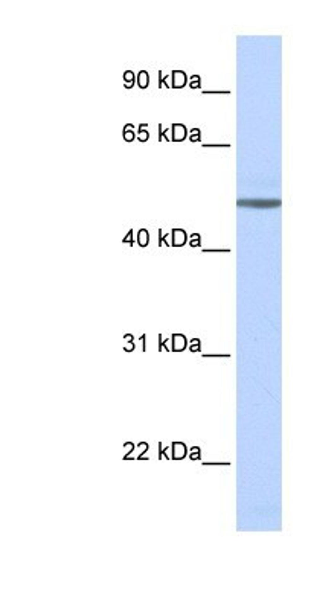 Western Blot: beta-1 Adrenergic R/ADRB1 Antibody [NBP1-59007] - Titration: 0.2-1 ug/ml, Positive Control: Human brain.