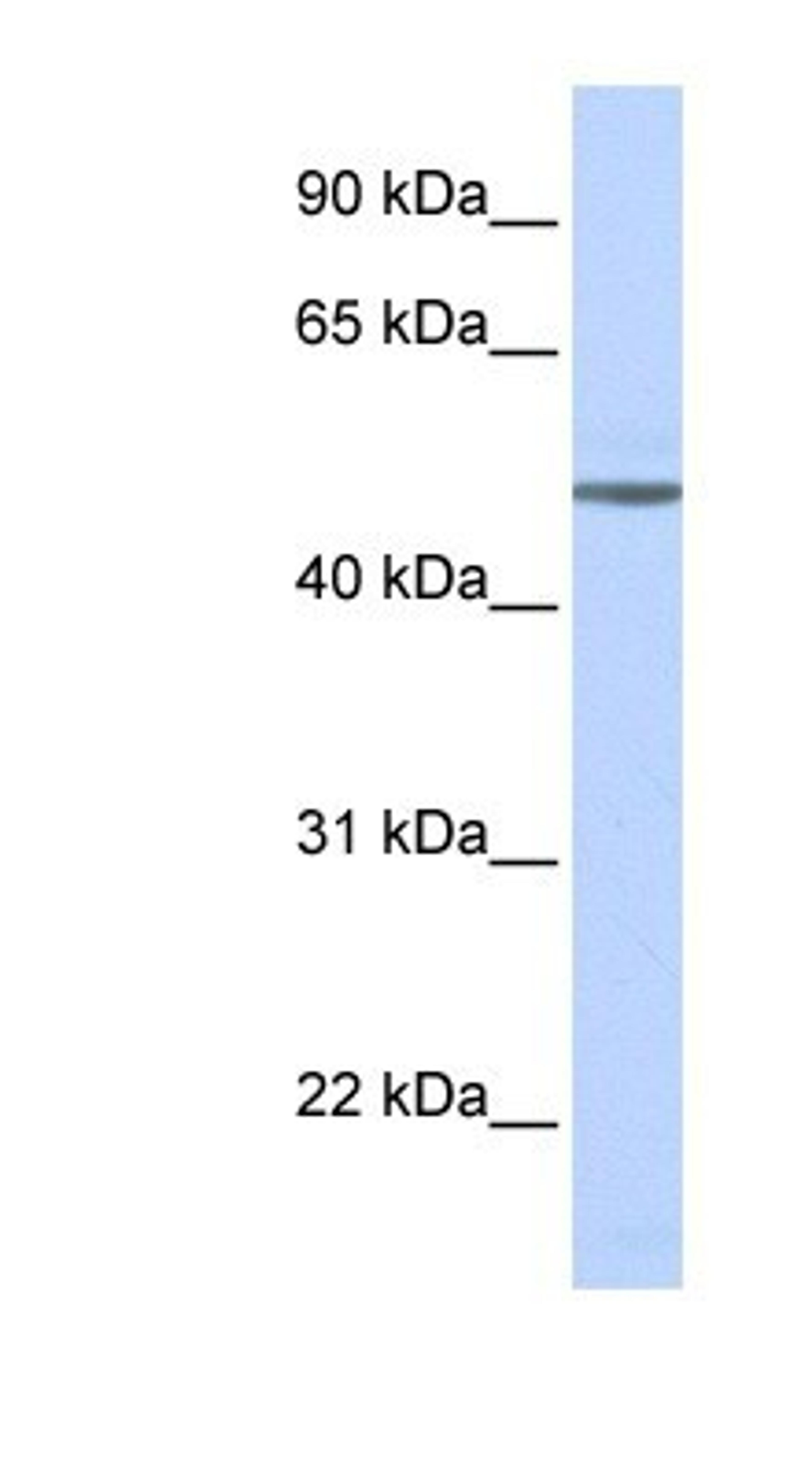 Western Blot: beta-1 Adrenergic R/ADRB1 Antibody [NBP1-59007] - Titration: 0.2-1 ug/ml, Positive Control: Human brain.