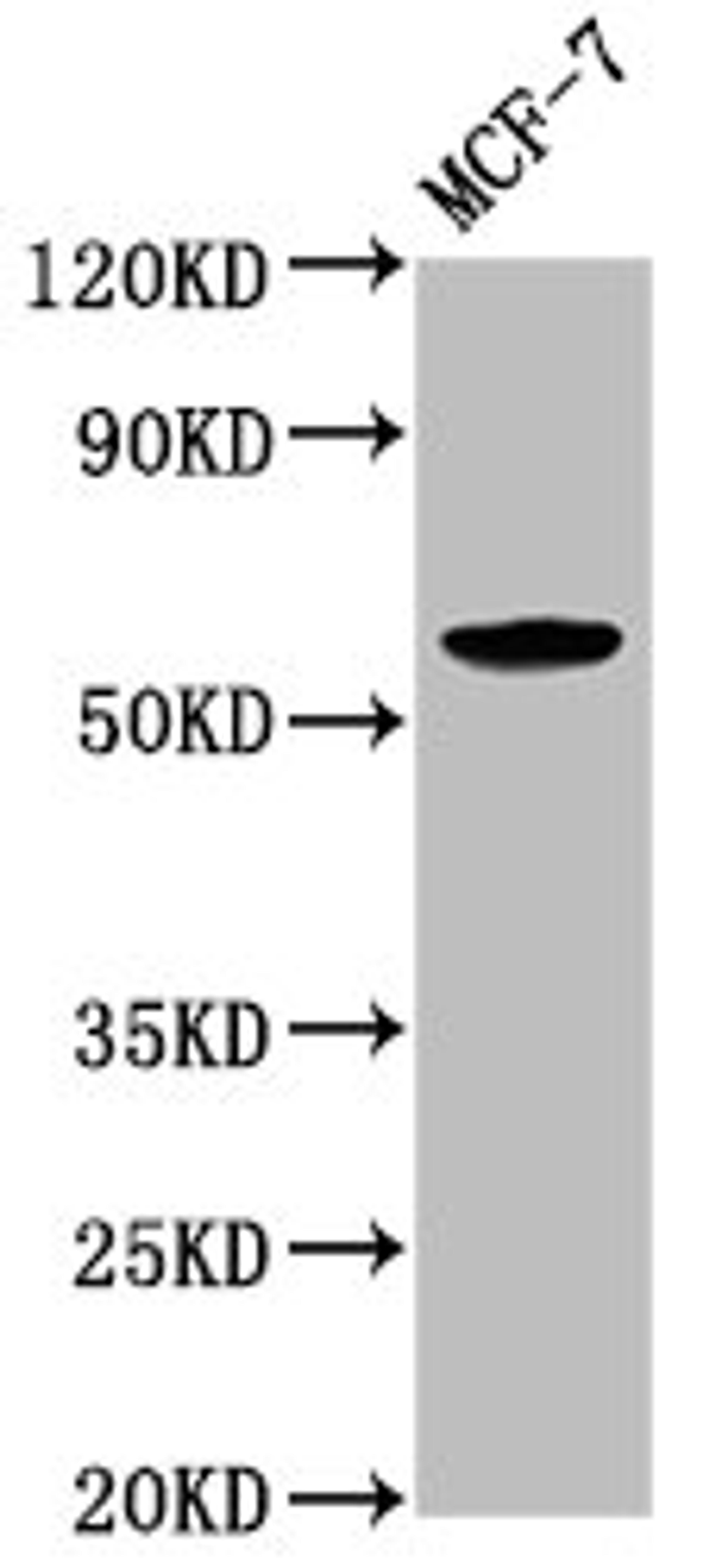 Western Blot. Positive WB detected in: MCF-7 whole cell lysate. All lanes: ILDR1 antibody at 2.6ug/ml. Secondary. Goat polyclonal to rabbit IgG at 1/50000 dilution. Predicted band size: 63, 58, 31, 24, 53, 60 kDa. Observed band size: 63 kDa. 