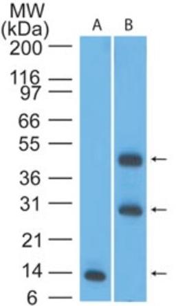 Western Blot: CRLF2 Antibody [NBP2-22384] - analysis of TSLPR in an A) partial recombinant protein (0.1 ug/ml) and B) human liver lysate (2ug/ml) using TSLPR antibody.