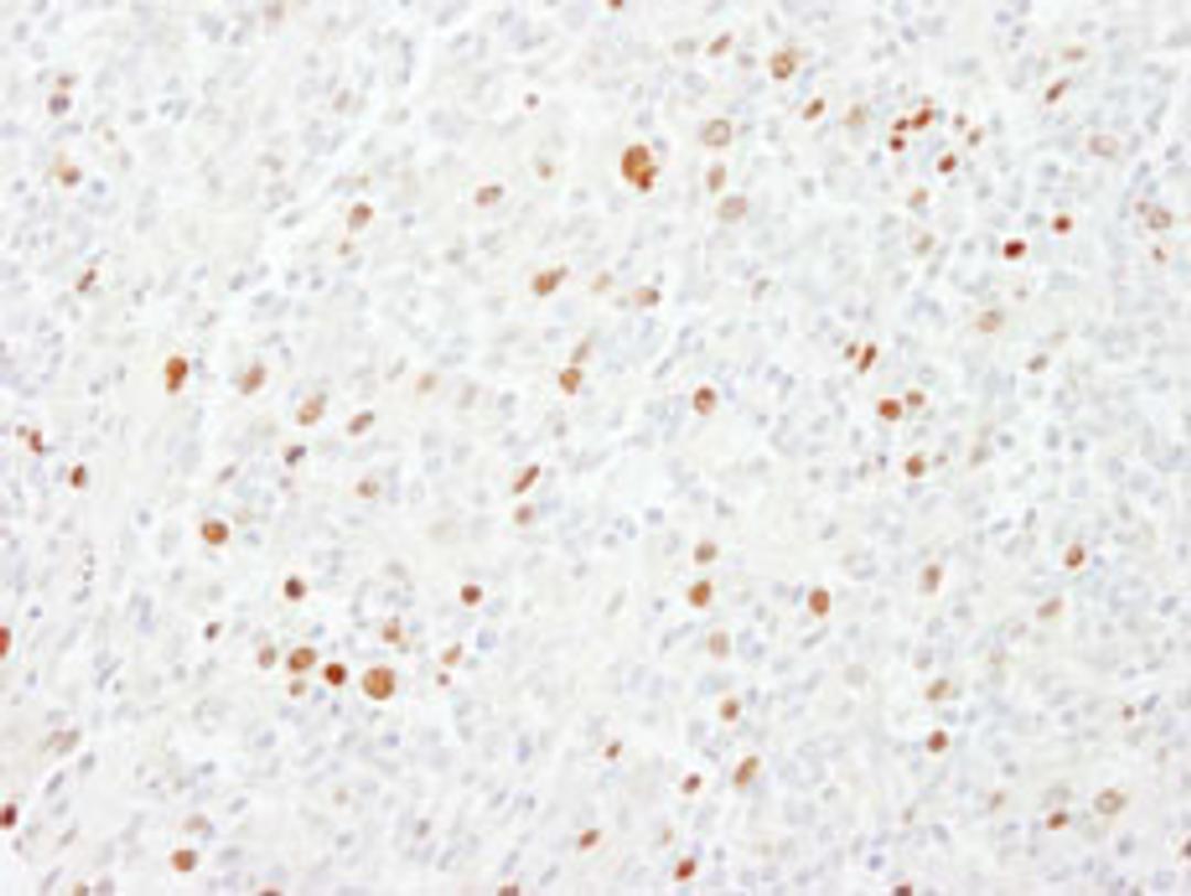 Detection of human CENP-F/Mitosin by immunohistochemistry.