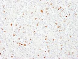 Detection of human CENP-F/Mitosin by immunohistochemistry.