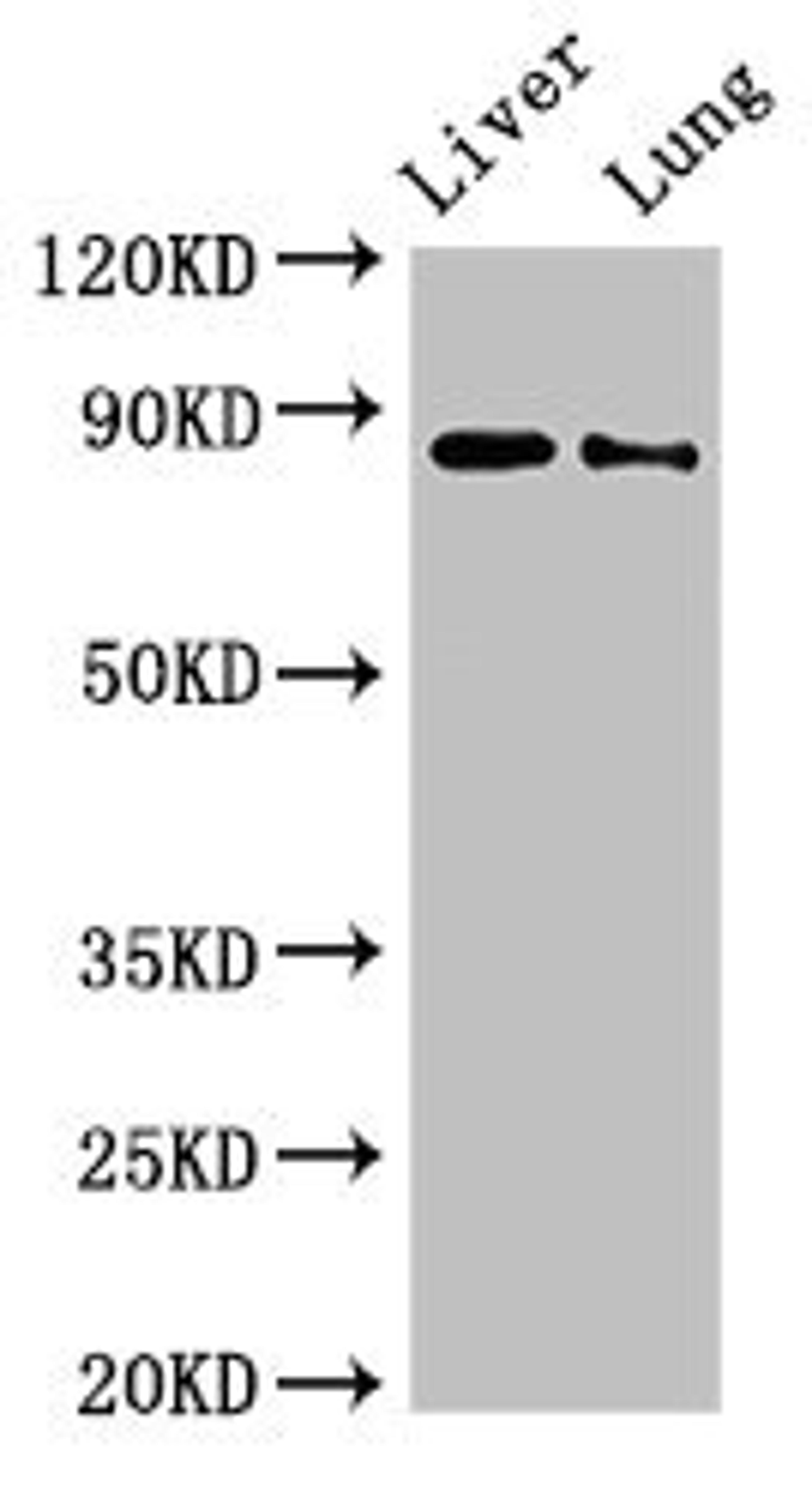 Western Blot. Positive WB detected in: Rat liver tissue, Rat lung tissue. All lanes: DENND1C antibody at 3ug/ml. Secondary. Goat polyclonal to rabbit IgG at 1/50000 dilution. Predicted band size: 88, 83 kDa. Observed band size: 88 kDa. 