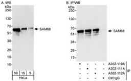 Detection of human SAM68 by western blot and immunoprecipitation.