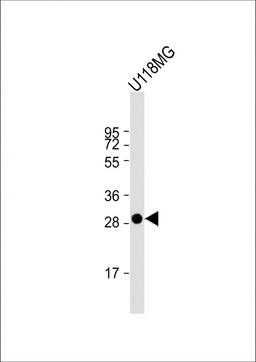 Western Blot at 1:1000 dilution + U118MG whole cell lysate Lysates/proteins at 20 ug per lane.